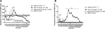 The key role of muscle spindles in the pathogenesis of myofascial trigger points according to ramp-and-hold stretch and drug intervention in a rat model